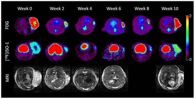 Series of brain PET and MRI scans displayed over several weeks.