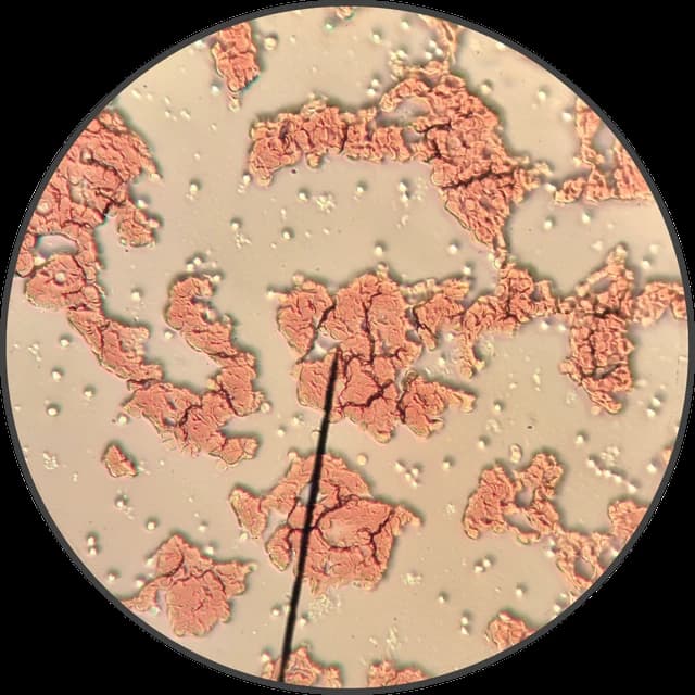 Human red blood cells visible under a microscope, showing cellular structures and clusters.